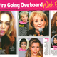Image for article titled This Week In Tabloids: Bony Arms, Matchstick Legs and Eating Disorders